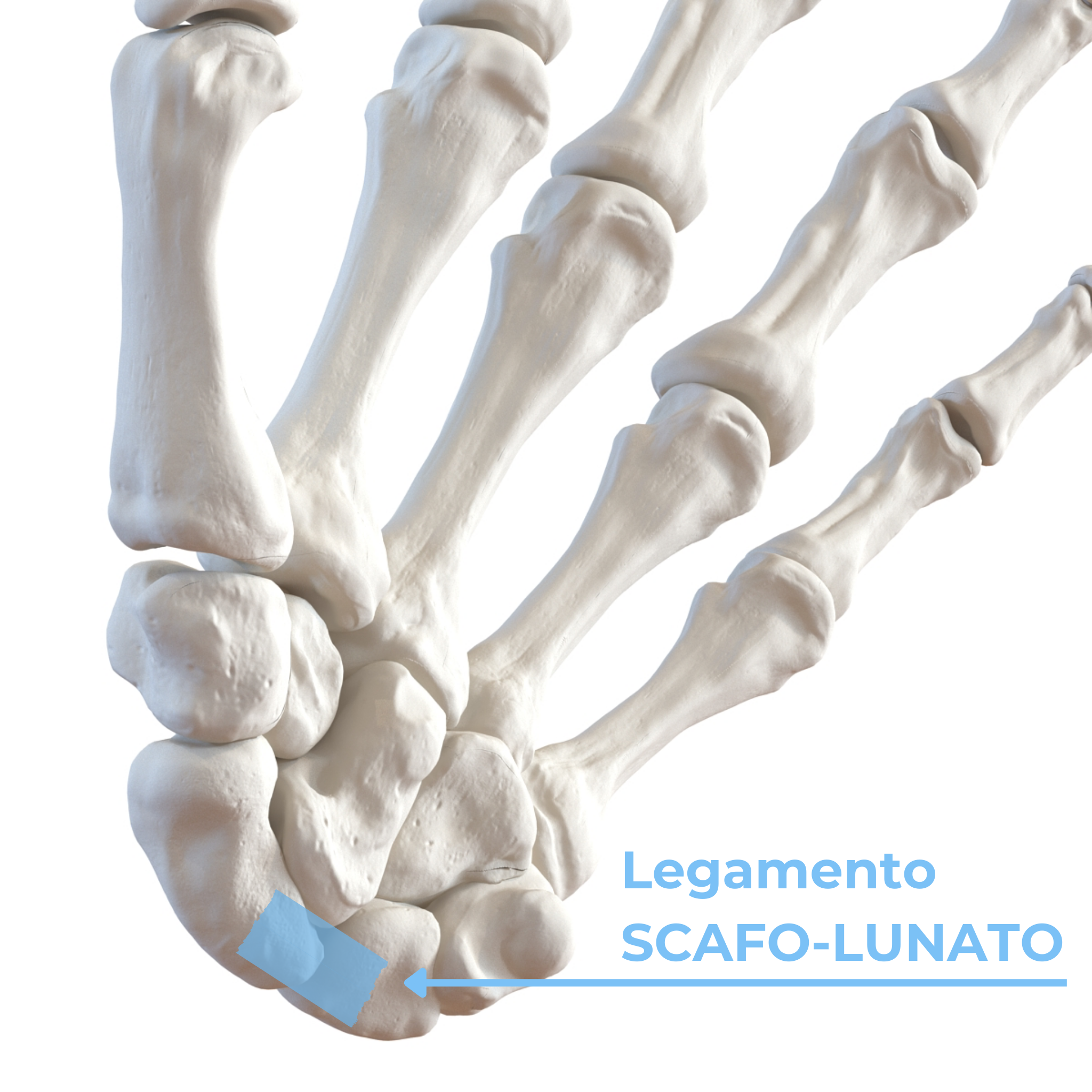 Le ossa delle filiere della mano, in particolare il legamento che unisce lo scafoide al semilunare, indicato in azzurro. Il suo nome è il legamento scafo-lunato.